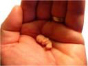 Embryo