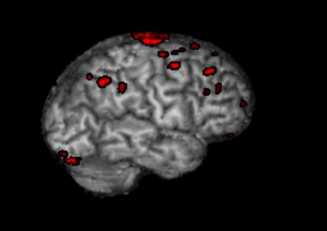 This is your brain on distraction.