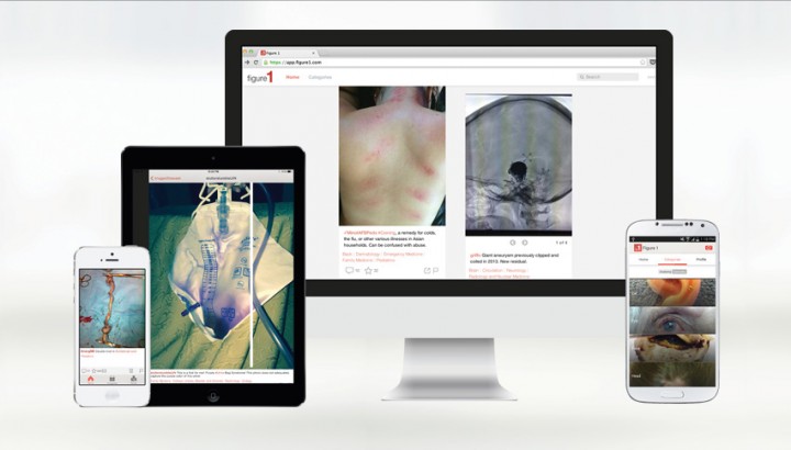 Figure 1, the Instagram for doctors, launches in India