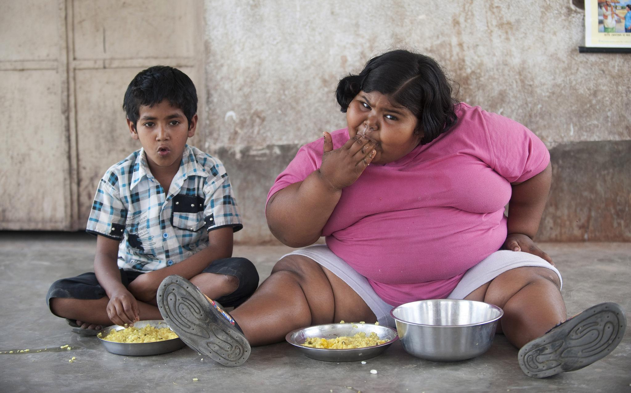 obesity in indian children