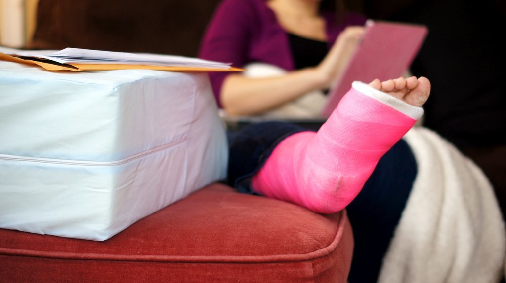 leg cast