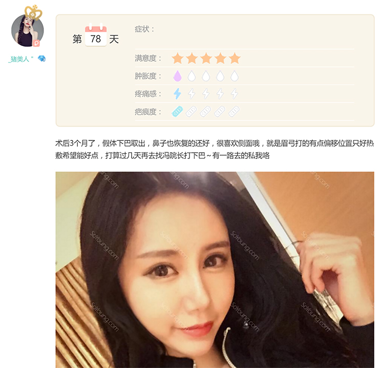 Screenshot from SoYoung.com